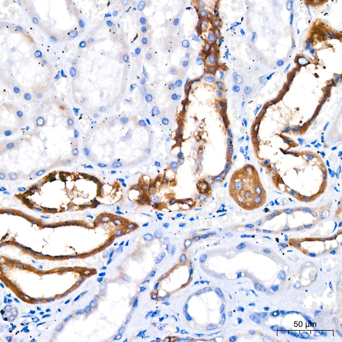 ACSL4 Rabbit monoclonal antibody