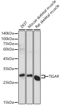 TIGAR Rabbit polyclonal antibody