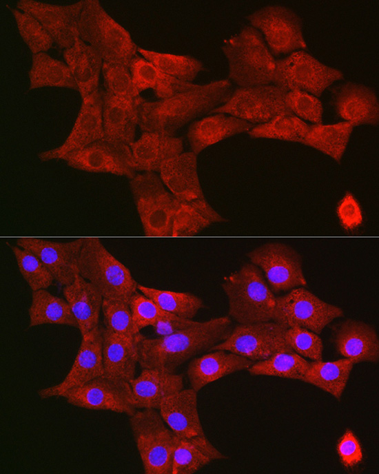 TIGAR Rabbit polyclonal antibody