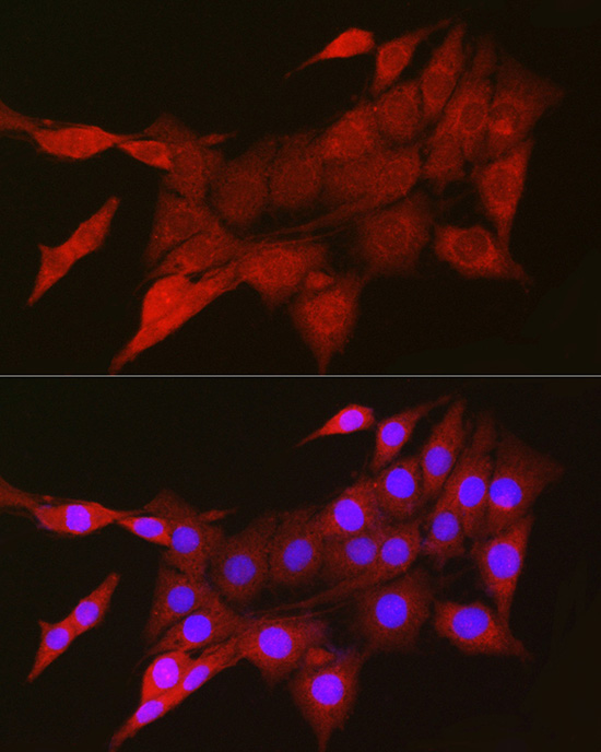 TIGAR Rabbit polyclonal antibody