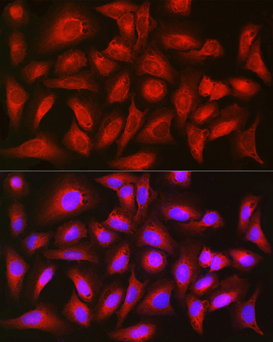 TIGAR Rabbit polyclonal antibody