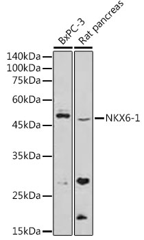 NKX6-1 Rabbit polyclonal antibody