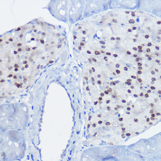 NKX6-1 Rabbit polyclonal antibody
