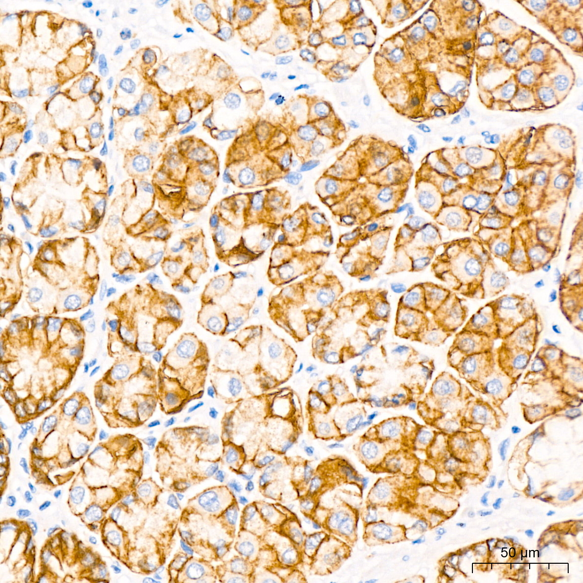 Claudin18.2 Rabbit monoclonal antibody
