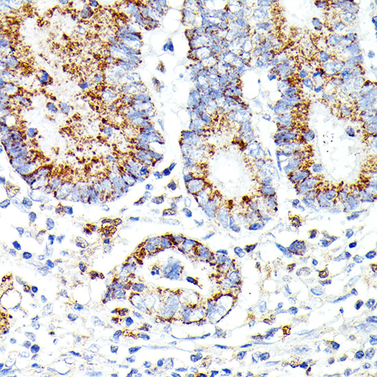 IL13RA2 Rabbit polyclonal antibody