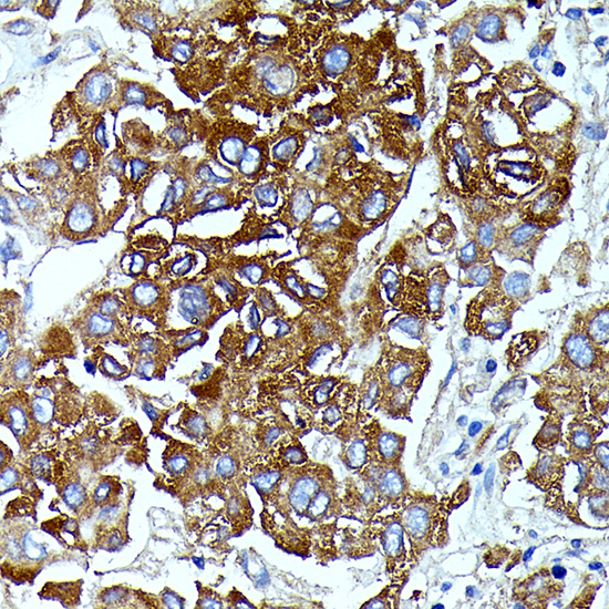 IL13RA2 Rabbit polyclonal antibody