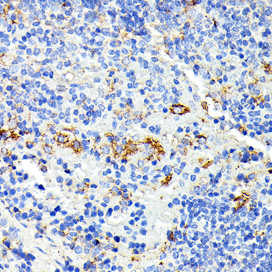 IL13RA2 Rabbit polyclonal antibody