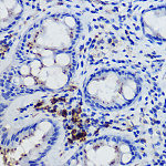 Immunohistochemistry - FPR1 Rabbit pAb (A20455)