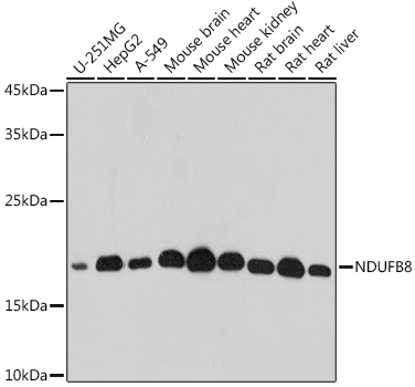 NDUFB8 Rabbit polyclonal antibody