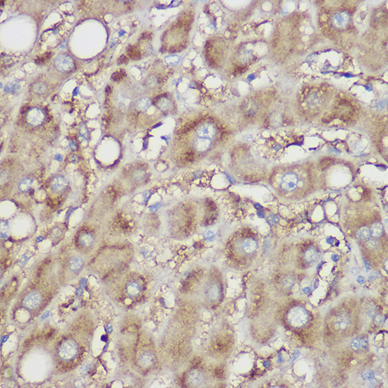 NDUFB8 Rabbit polyclonal antibody