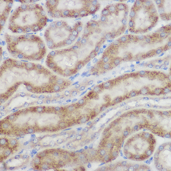 NDUFB8 Rabbit polyclonal antibody