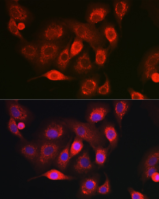 NDUFB8 Rabbit polyclonal antibody