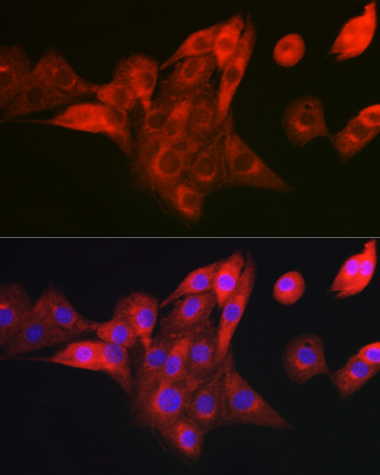 NDUFB8 Rabbit polyclonal antibody