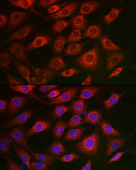Syntrophin alpha 1 Rabbit polyclonal antibody