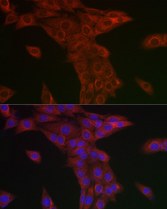Syntrophin alpha 1 Rabbit polyclonal antibody