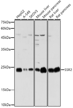 SSR2 Rabbit polyclonal antibody