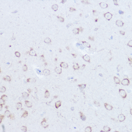 SSR2 Rabbit polyclonal antibody