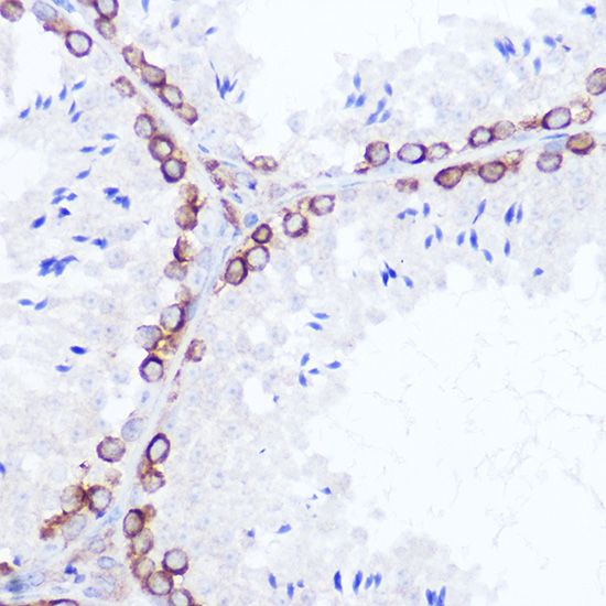 SSR2 Rabbit polyclonal antibody
