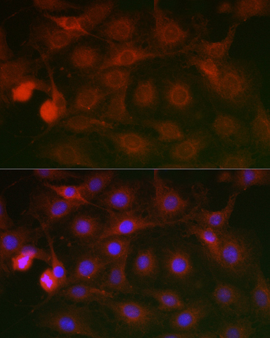SSR2 Rabbit polyclonal antibody