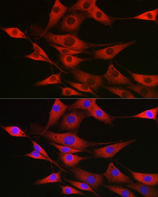 SSR2 Rabbit polyclonal antibody