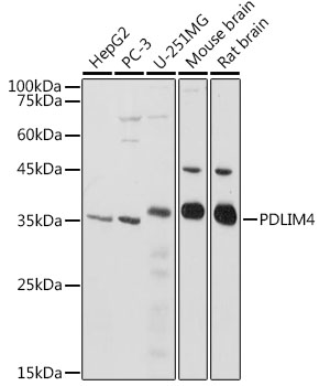 PDLIM4 Rabbit polyclonal antibody