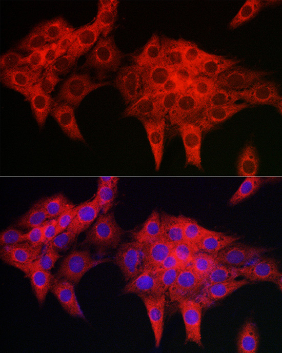 PDLIM4 Rabbit polyclonal antibody