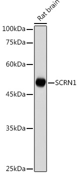 SCRN1 Rabbit polyclonal antibody