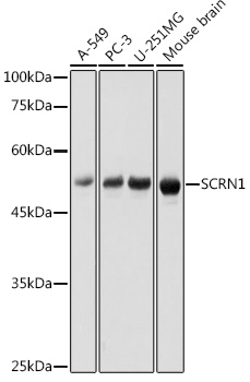SCRN1 Rabbit polyclonal antibody