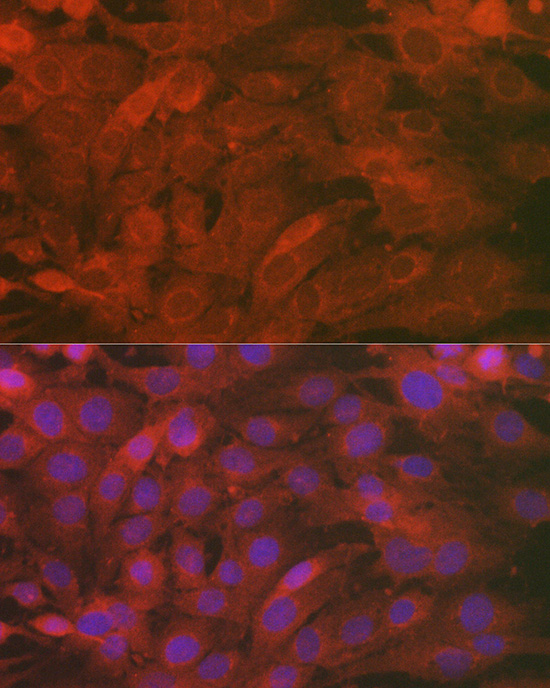 SCRN1 Rabbit polyclonal antibody