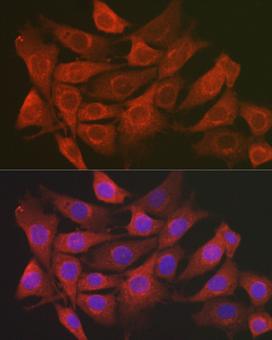 SCRN1 Rabbit polyclonal antibody