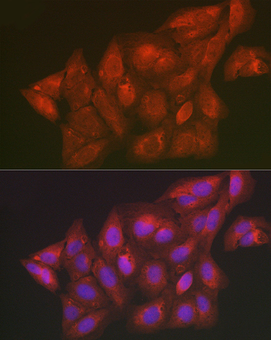 SCRN1 Rabbit polyclonal antibody