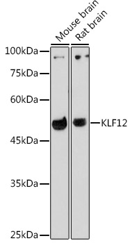KLF12 Rabbit polyclonal antibody