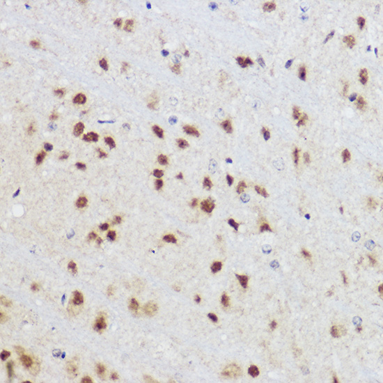 KLF12 Rabbit polyclonal antibody