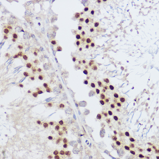 KLF12 Rabbit polyclonal antibody