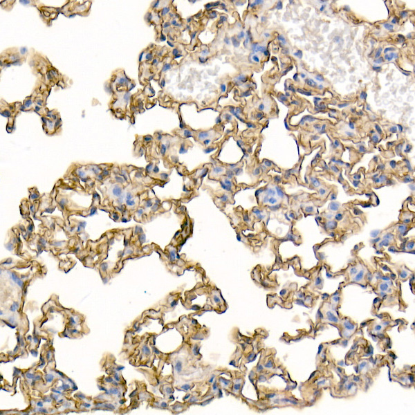 ICAM1 Rabbit polyclonal antibody