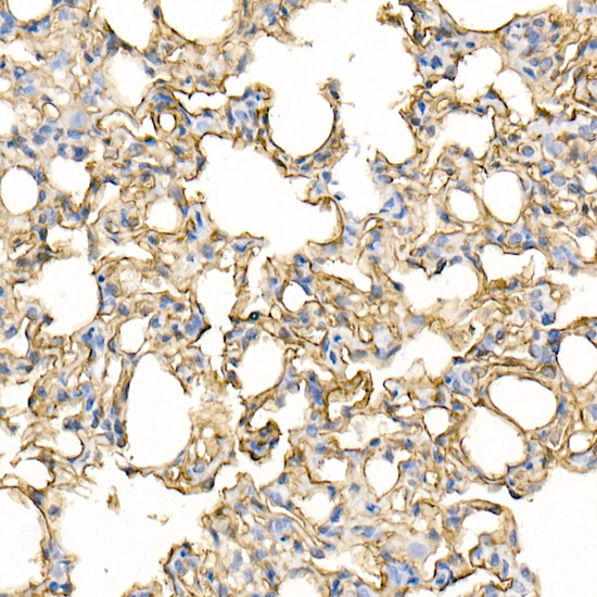 ICAM1 Rabbit polyclonal antibody