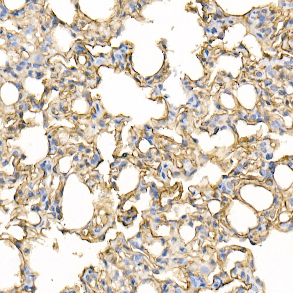ICAM1 Rabbit polyclonal antibody