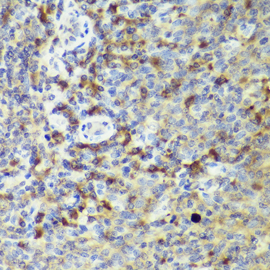 IL18 Rabbit polyclonal antibody