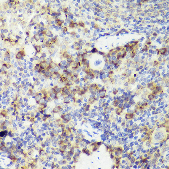IL18 Rabbit polyclonal antibody