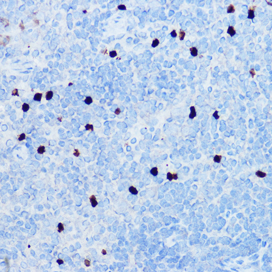 S100A8 Rabbit polyclonal antibody
