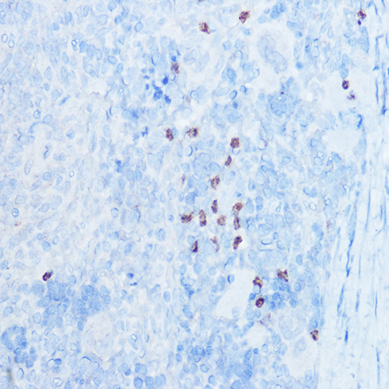 S100A8 Rabbit polyclonal antibody