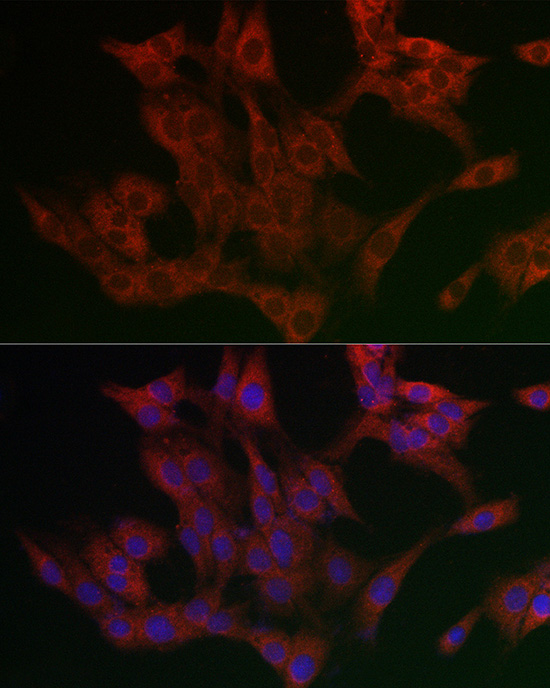 FAF2 Rabbit polyclonal antibody