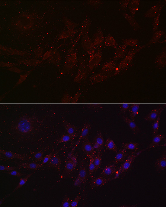 MGRN1 Rabbit polyclonal antibody