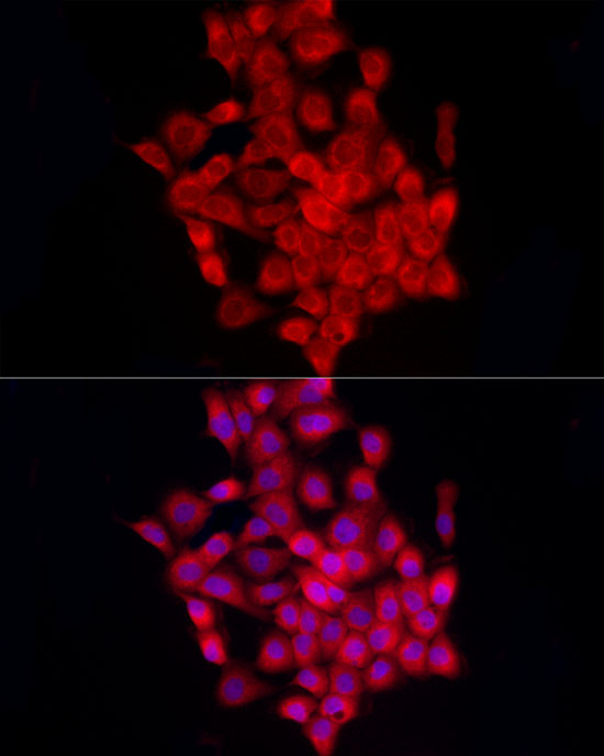 ADRB2 Rabbit polyclonal antibody