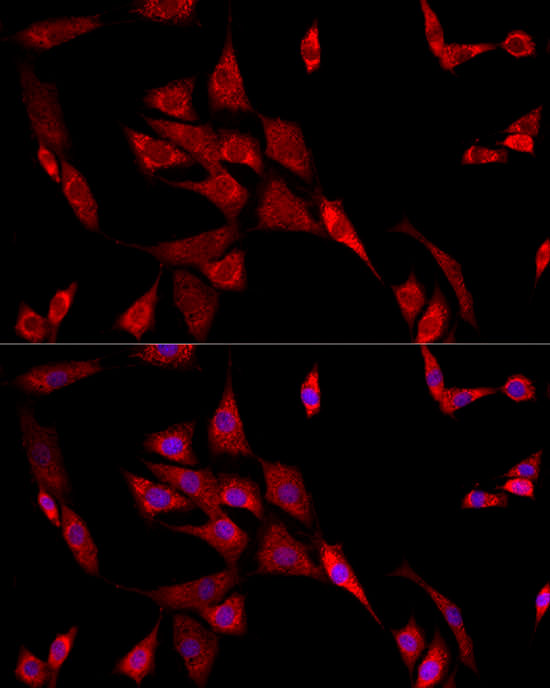 ADRB2 Rabbit polyclonal antibody