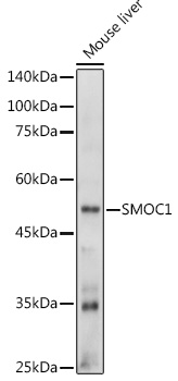 SMOC1 Rabbit polyclonal antibody