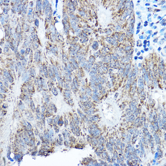 SMOC1 Rabbit polyclonal antibody