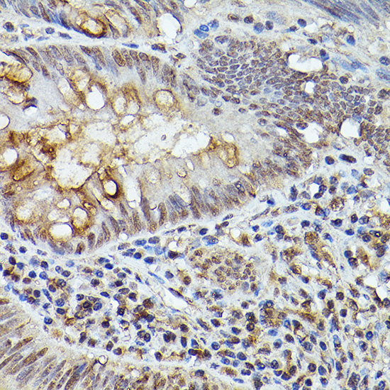 TASL Rabbit polyclonal antibody