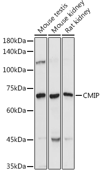 CMIP Rabbit polyclonal antibody