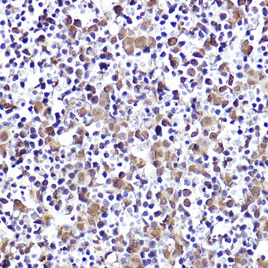 CMIP Rabbit polyclonal antibody